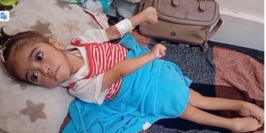 الرضيعة مريم أبو مصطفى ولدت في غزة أثناء الحرب وإعاقة دماغية تهدد حياتها - الأول نيوز