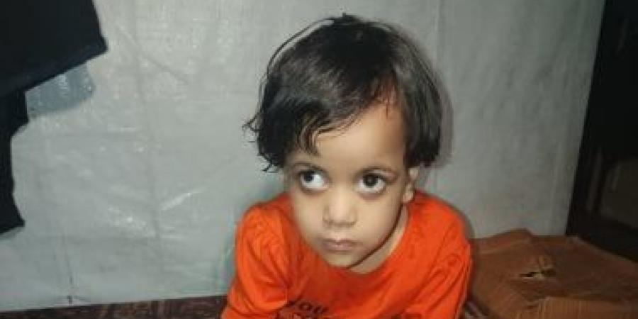 سيلا النجار طفلة تولد مرتين تحت النار.. صراع مع المرض ونقص الدواء فى غزة - الأول نيوز