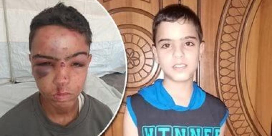 صرخة استغاثة من غزة.. نوبات الصرع والتشنجات تهدد حياة الطفل عبد الله عصفور - الأول نيوز